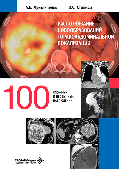Распознавание новообразований торако-абдоминальной локализации. 100 сложных и необычных наблюдений