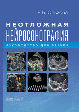 Неотложная нейросонография. Руководство