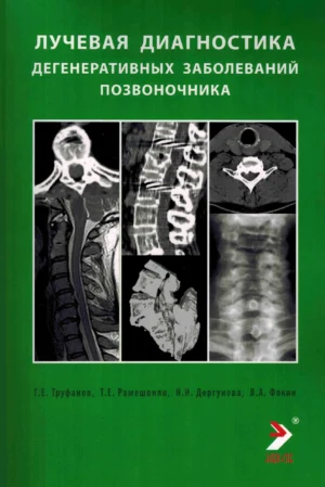 Лучевая диагностика дегенеративных заболеваний позвоночника