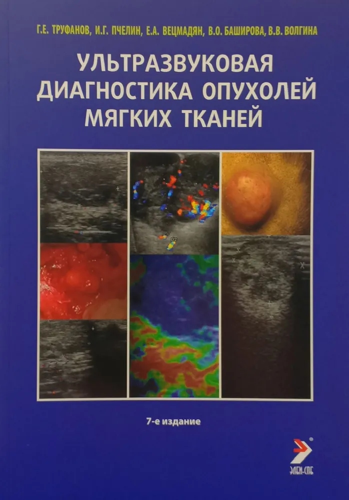 Ультразвуковая диагностика опухолей мягких тканей. 7-е издание