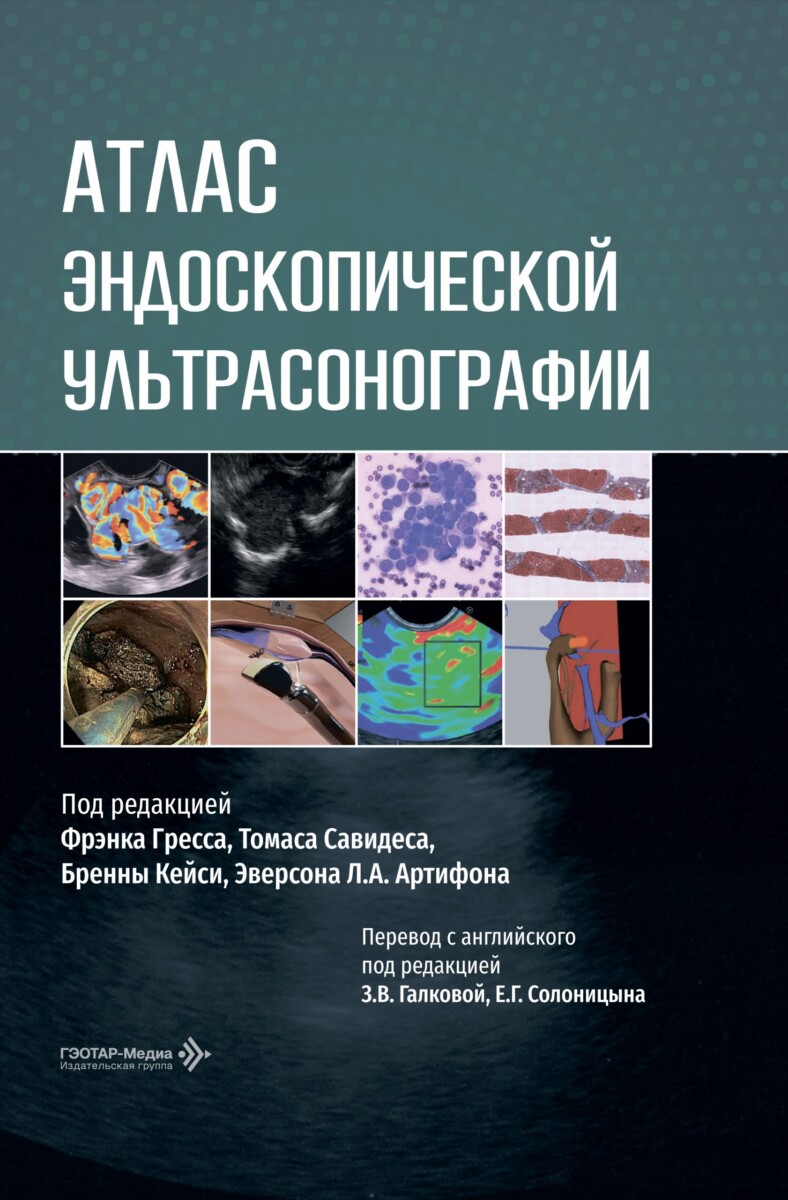 Атлас эндоскопической ультрасонографии