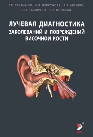 Лучевая диагностика заболеваний и повреждений висточной кости. Конспект лучевого диагноста. 5-е издание
